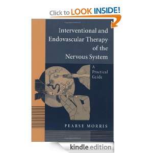 Interventional and Endovascular Therapy of the Nervous System Pearse 
