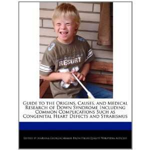 , Causes, and Medical Research of Down Syndrome Including Common 