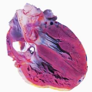  A Lateral Section of the Human Heart Showing the 