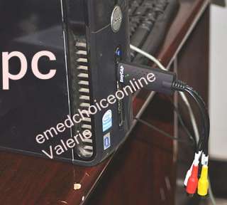   Electronic Colposcope SONY Camera 830,000 pixels 100% Warranty  