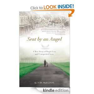   Loss and Unexpected Love Kevin Skelton  Kindle Store